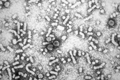Micrographie du virus de l'hépatite B