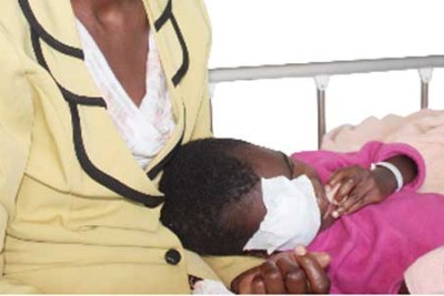 Eye Cancer in Children on the rise in Tanzania.