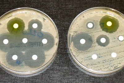 Antibiotic resistance tests - the bacteria in the culture on the left are sensitive to the antibiotics contained in the white paper discs. The bacteria on the right are resistant to most of the antibiotics (file photo).