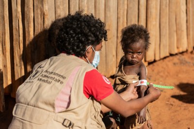 Mesure du périmètre brachial d'un enfant d'Ambovombe, un des quartiers à très haut taux d'enfants malnutris.